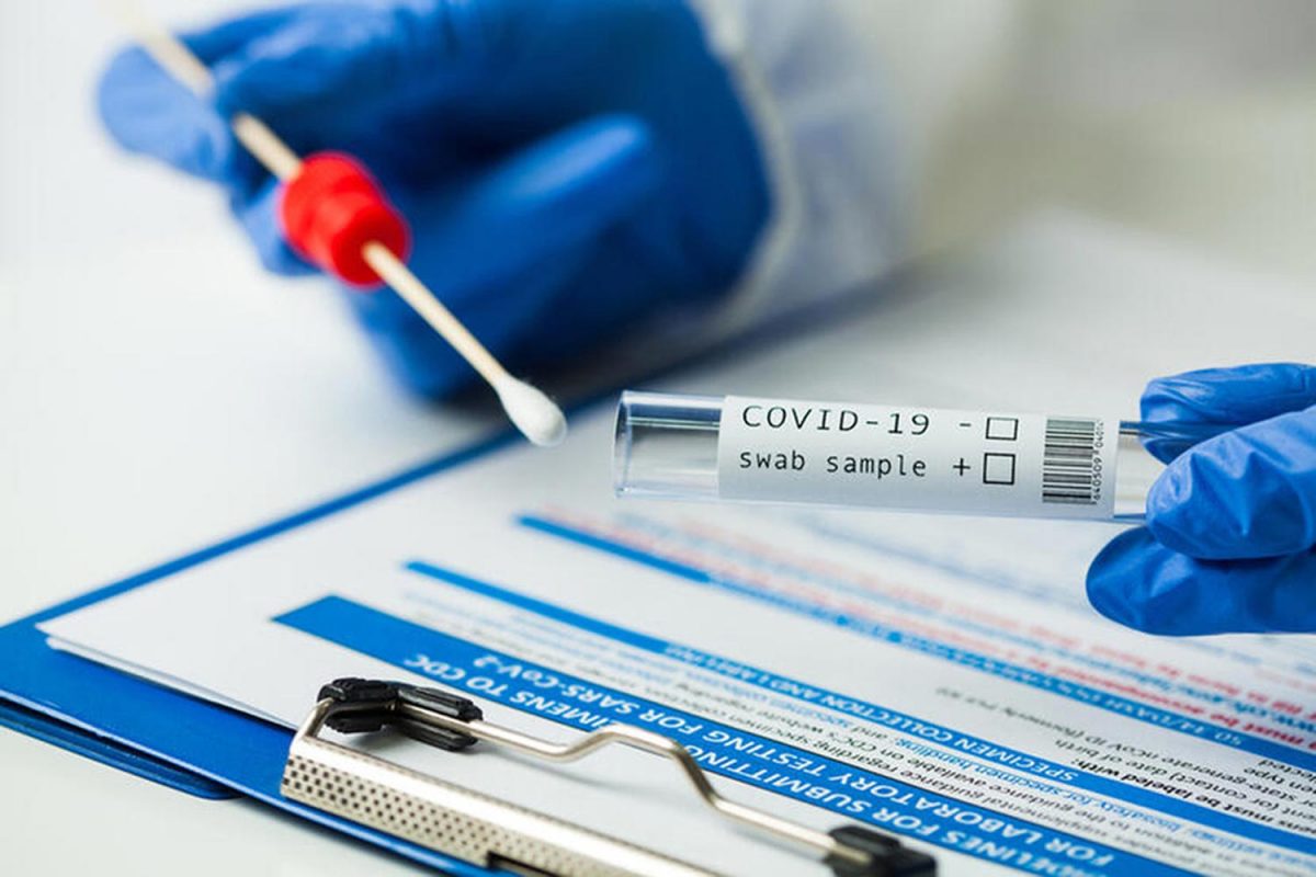 COVID-19 PCR Test