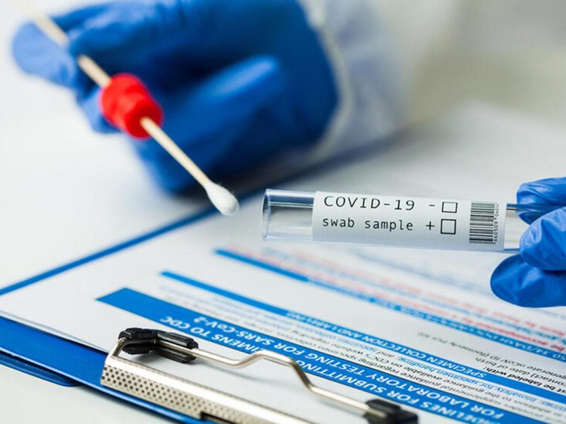 COVID-19 PCR Test